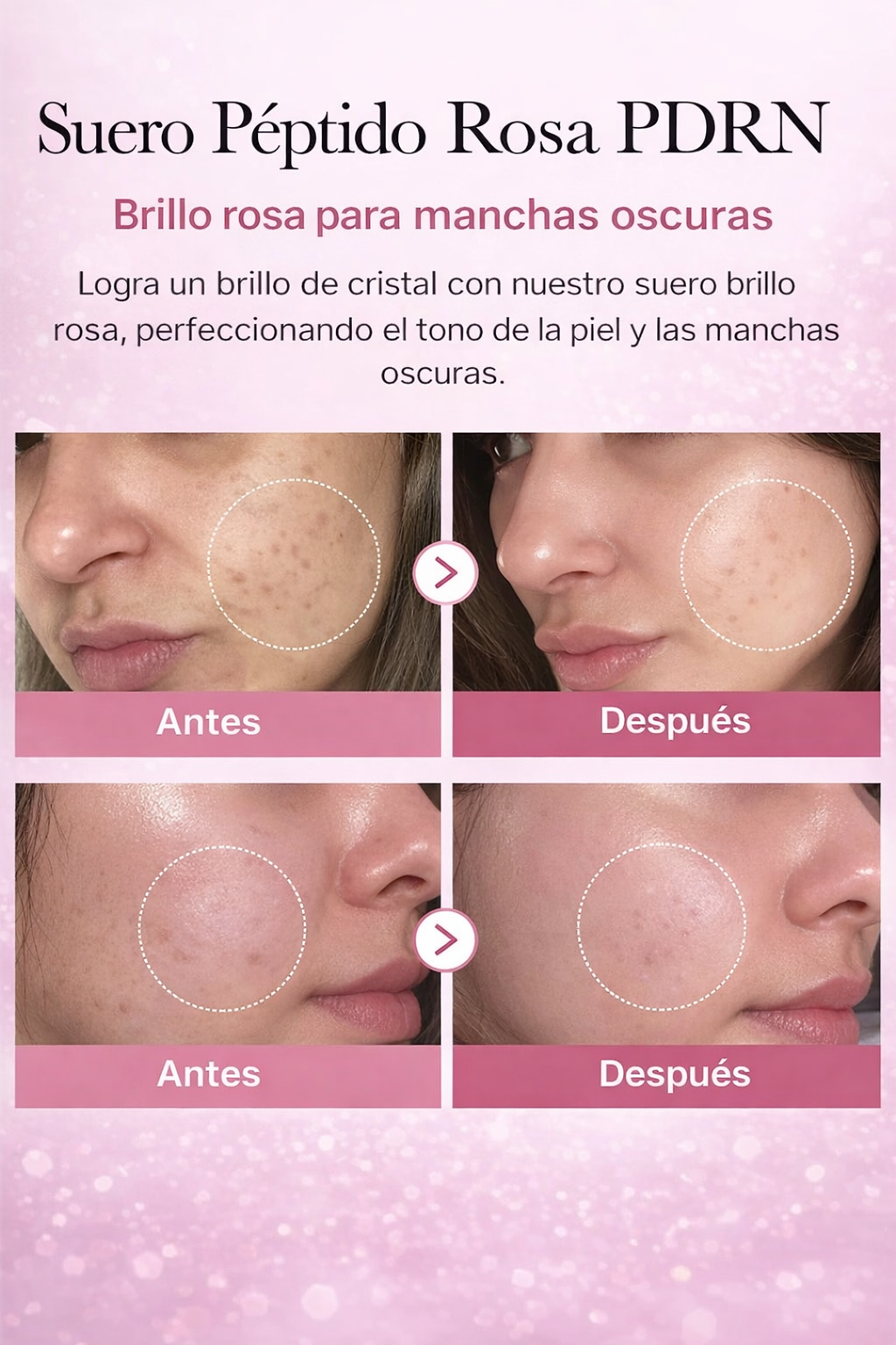 Rose PDRN- Serum Facial De Salmon