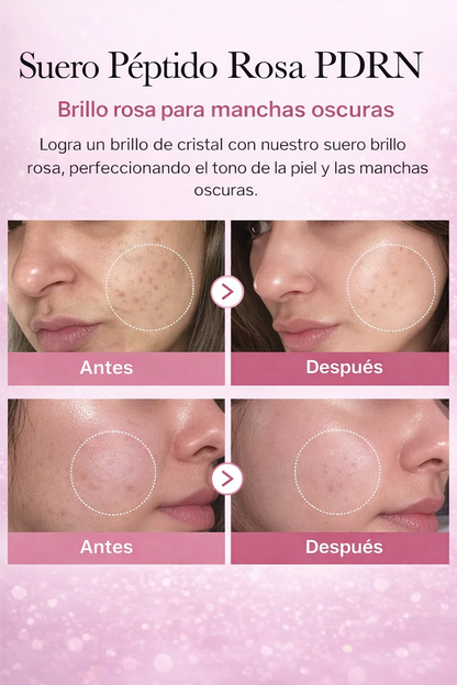 Rose PDRN- Serum Facial De Salmon